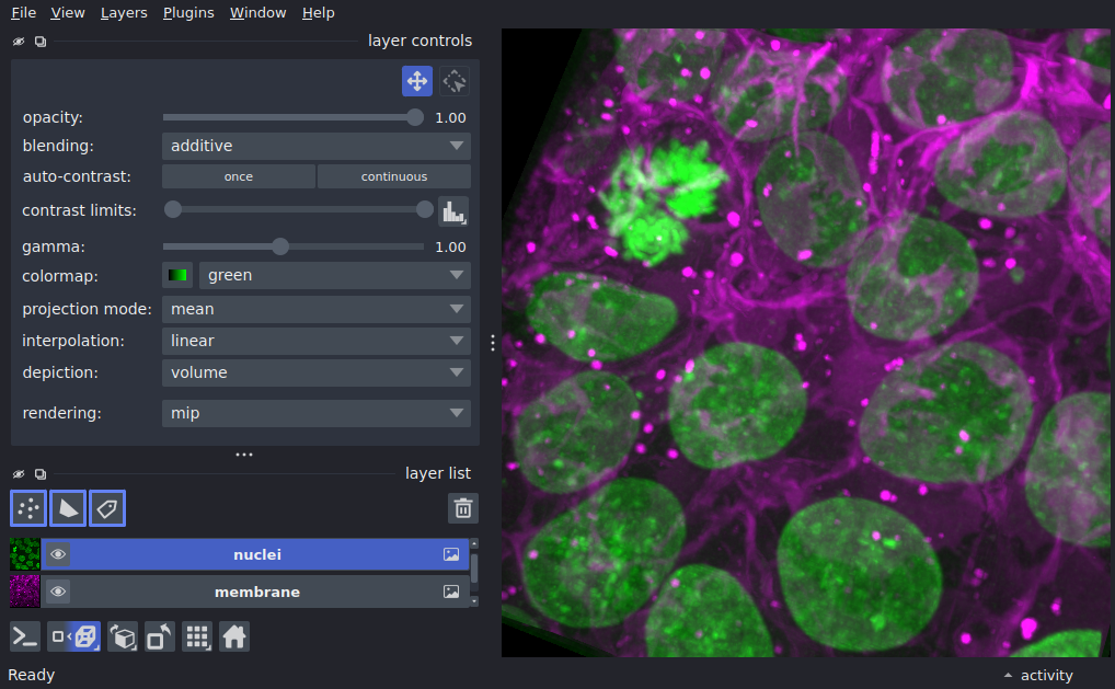 stereo viewer widget